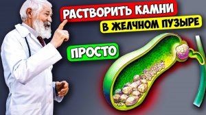 Старый доктор признался, как растворить Камни в Желчном Пузыре и Печени без операции!