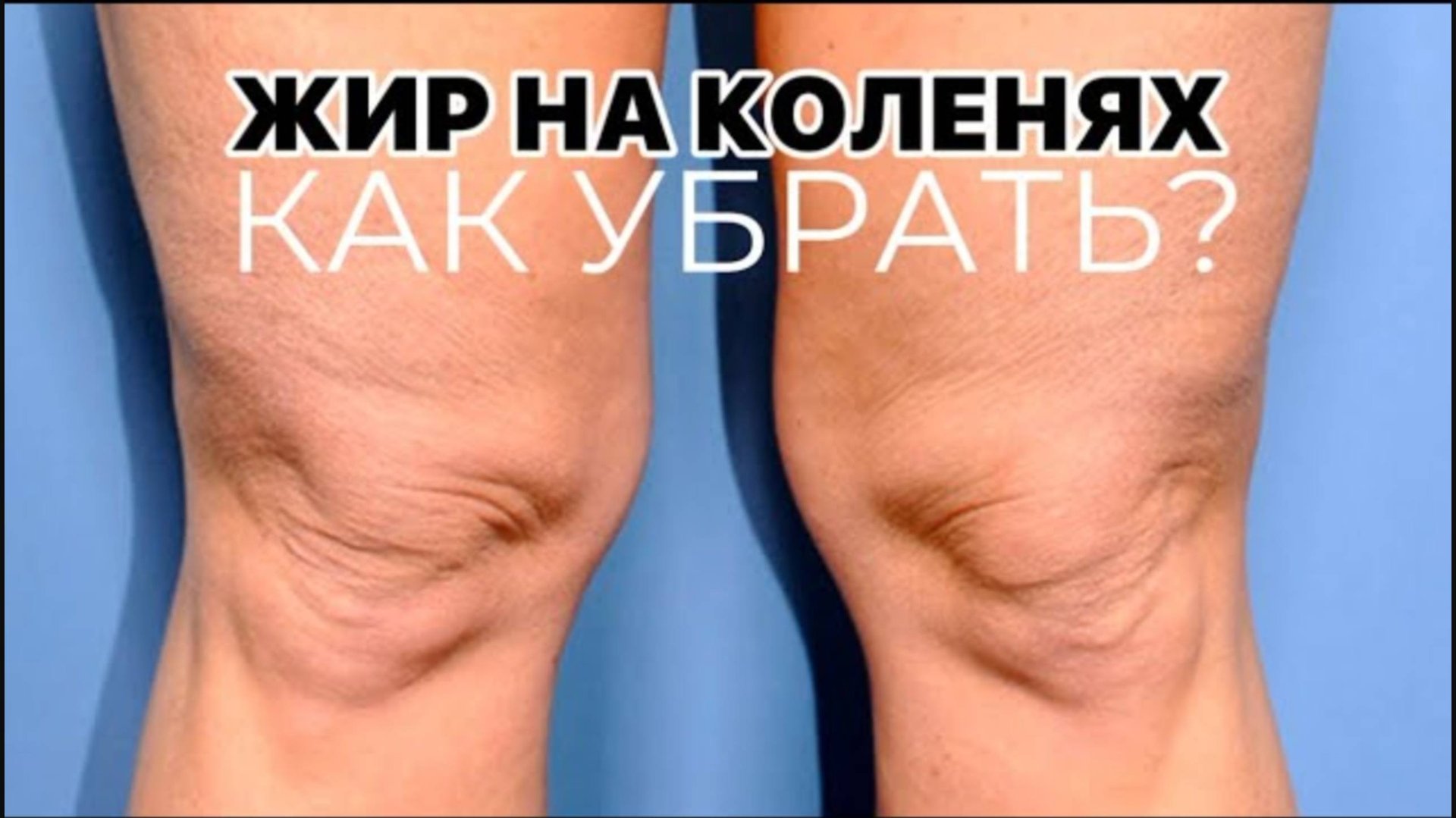 Жир на коленях. Как убрать жир и дряблость с колен навсегда. Лучшие упражнения на эту зону. смотреть онлайн