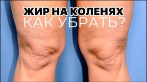 Жир на коленях. Как убрать жир и дряблость с колен навсегда. Лучшие упражнения на эту зону.
