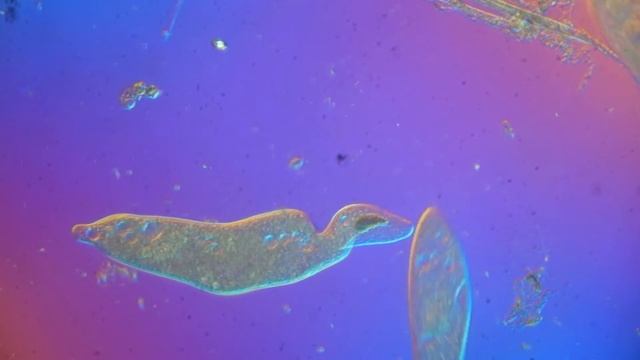 Loxophyllum Meleagris and Ciliophora смотреть онлайн