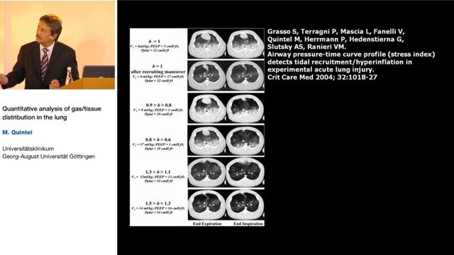 Quantative analysis of gas tissue distribution M Quintel 2005 Strasb