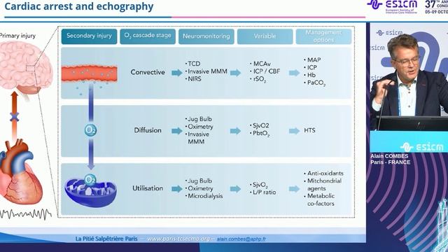 Cardiac arrest and echography Alain Combes ESICM 2024