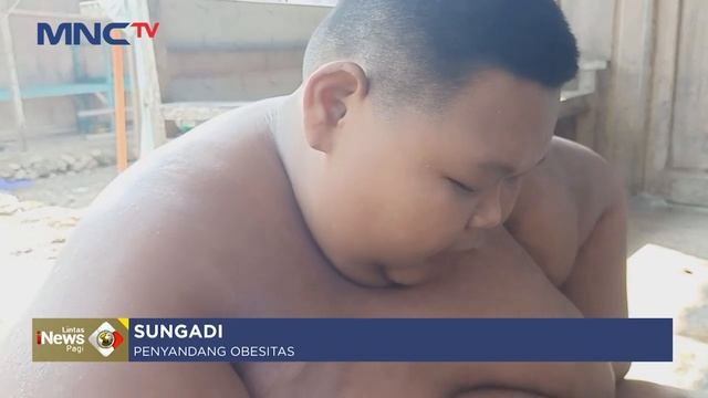 Kisah Sungadi, Pemuda Asal Sragen Penderita Obesitas Berharap Bantuan Pemda - LIP 27/05