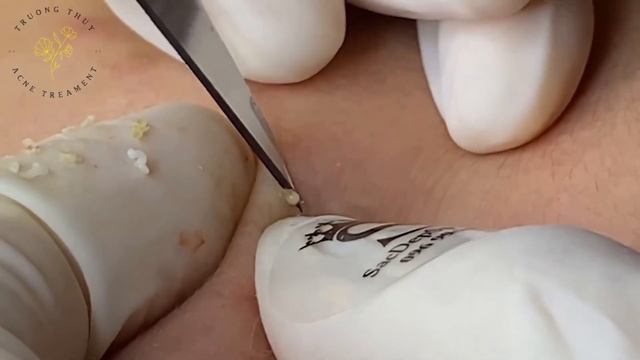Make Your Day Satisfying with THUY TRUONG SPA New Videos #359 смотреть онлайн