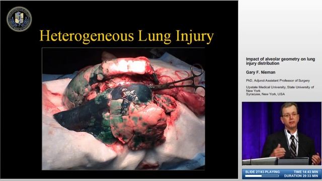 Impact of alveolar geometry on lung injury G.F.Nieman (NY-2006)
