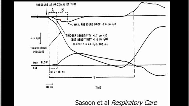 WOB work of breathing. Heulitt M (2004)