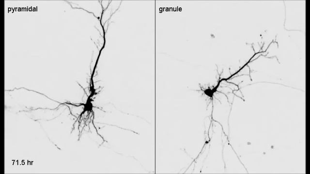 PLoS ONE : Differentiation of Apical and Basal Dendrites in Pyramidal Cells and Granule Cells... смотреть онлайн