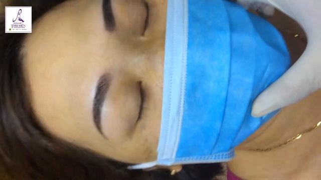quang cao vi soi 28 7 17 смотреть онлайн