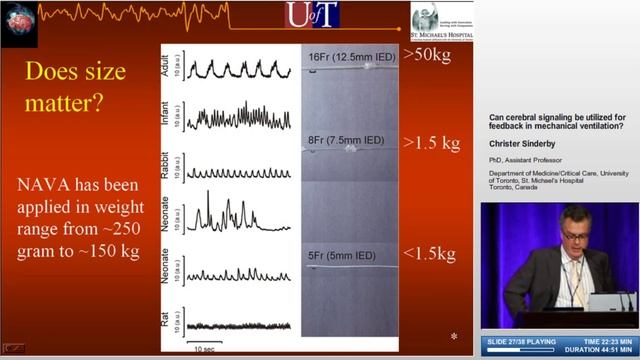 Cerebral signal C.Sinderby 1  (NY-2006)
