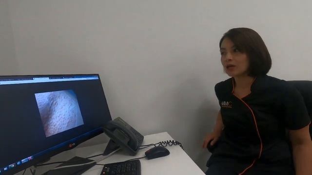 Laser Side Effect Na  PFE(Perifollicular Edema) Discussion With Ate BEV..