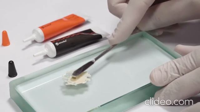 MTA Fillapex Working Process endodontic treatment. смотреть онлайн