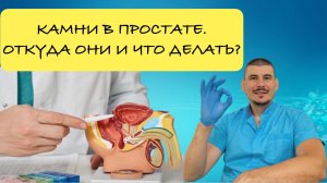 Камни в простате. Откуда они и что делать?