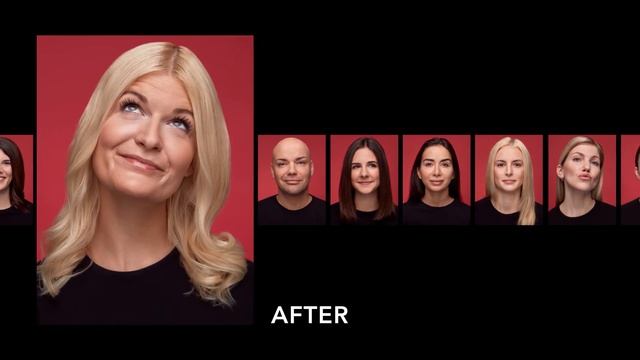 Belotero Lips Before and After Video смотреть онлайн