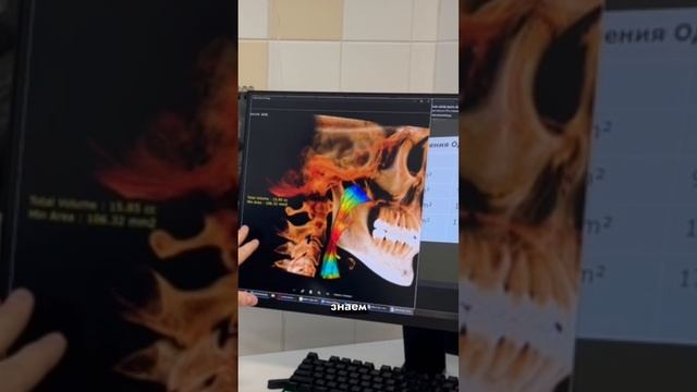 ВЛИЯНИЕ ГНАТОЛОГИИ НА ОБЪЁМЫ ВЕРХНИХ ДЫХАТЕЛЬНЫХ ПУТЕЙ смотреть онлайн