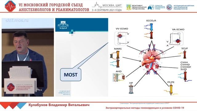 Экстракорпоральные методы при Ковид-19 Кулабухов ВВ 2021