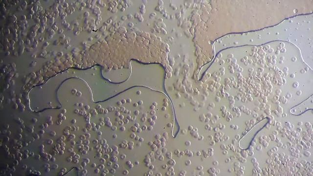 Blood Cells In Very High Quality (800X) смотреть онлайн