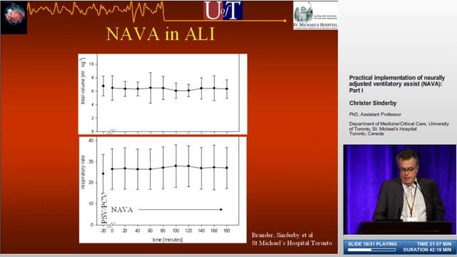 Practical implementation of NAVA (Part I) C Sinderby(NY-2006)