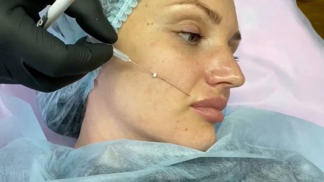 МЕЗОНИТИ смотреть онлайн