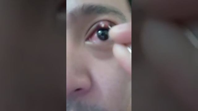 Popping eye stye ( warning gross pus ) смотреть онлайн