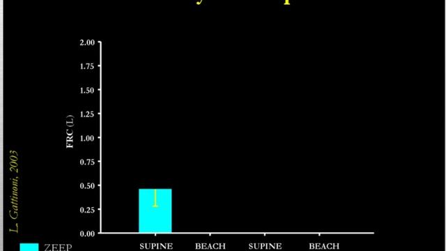 MV in IAH -intra abdominal hypertensioon Gattinonni L (2004)