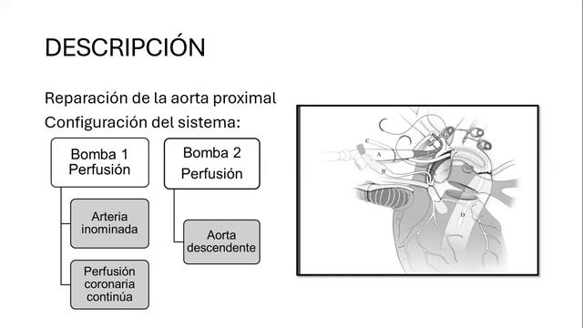 Perfusión todas las regiones смотреть онлайн