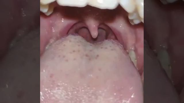 Vore смотреть онлайн