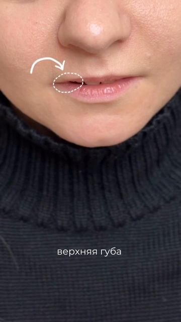 Стало лучше?😍 Больше работ и пользы в нашем тг #увеличениегуб #допосле