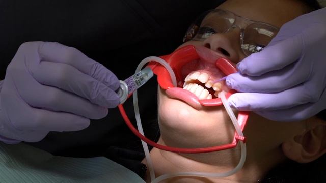 Getting Braces- Its Easy! смотреть онлайн