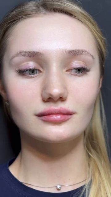 Внимание! Чей ангел потерялся   Такая нежнятина))) #увеличениегуб #косметология