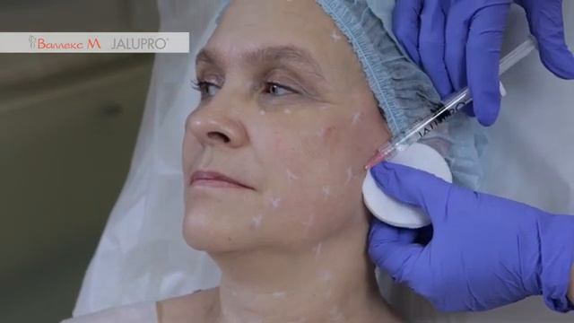 Протокол аминокислотной реставрации кожи "Аватар" смотреть онлайн