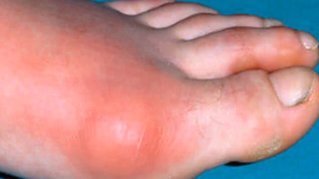 Yurak, Buyrak, Koz Va Jigarga Foydali Sharbatlar