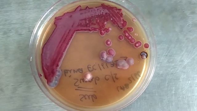 Serratia Marcescens And Klebsiella Pneumoniae Growth On Macconkey Agar Demonstration