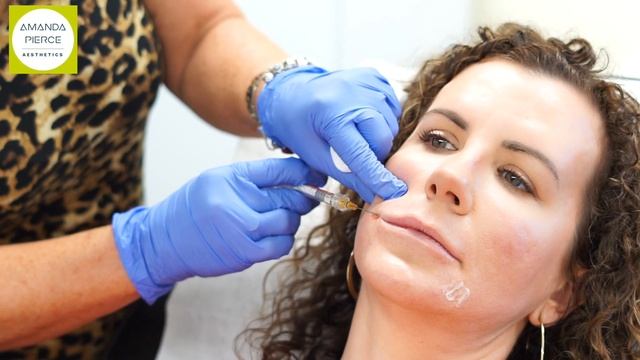 LIP FILLER DEMONSTRATION | WITH DENTAL BLOCK AND CANNULA смотреть онлайн