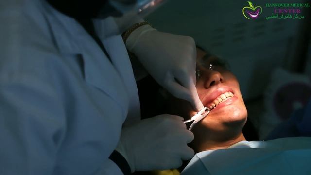 تقويم الأسنان смотреть онлайн