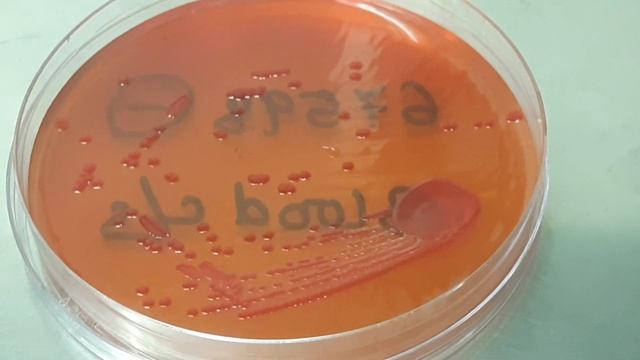 Burkholderia cepacia growth on Macconkey agar смотреть онлайн