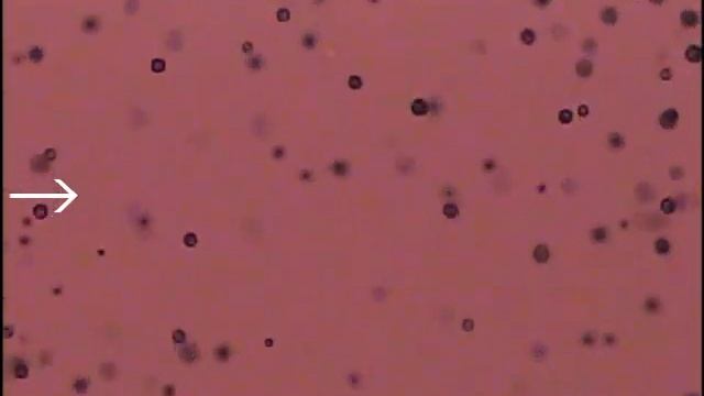 シアワセモは強い光から逃げずに防御する～4細胞緑藻シアワセモの近縁藻類とは異なる生存戦略を発見～（動画1） смотреть онлайн