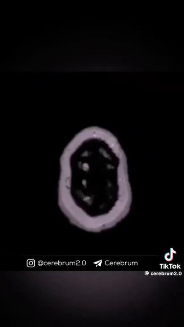 жизнь одна!!! смотреть онлайн