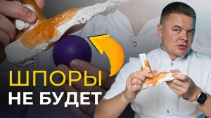 Как Избавиться от Боли в Пятке: Эффективные Способы Лечения Пяточной Шпоры