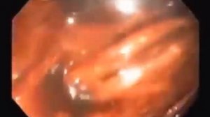 Кишечник, взгляд изнутри. Откуда появляются болезни.