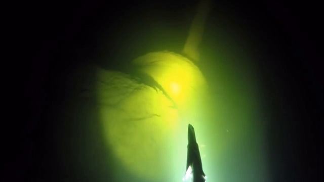 СЛР смотреть онлайн