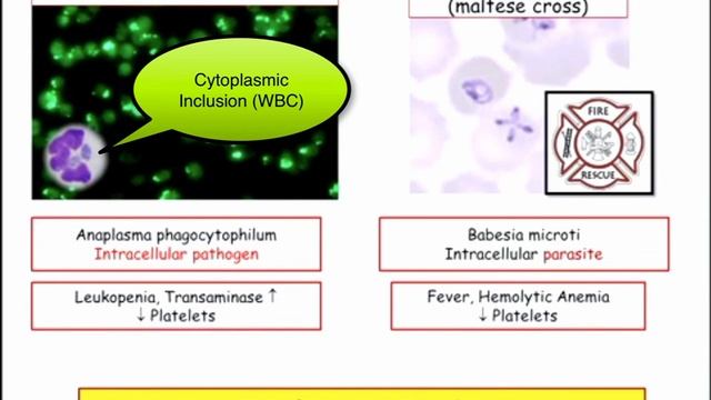 12DaysinMarch, Podcast Edition, Lyme (Ixodes) Coinfection for the USMLE Step One Exam смотреть онлайн
