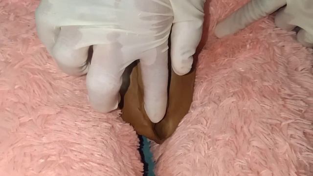 ASSESSING FEMALE GENITALIA, AND RECTUM смотреть онлайн