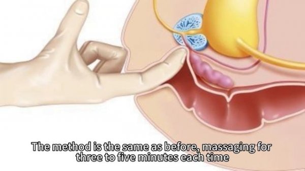 Prostate Massage Series 2- Massage Methods for Prostate Health
