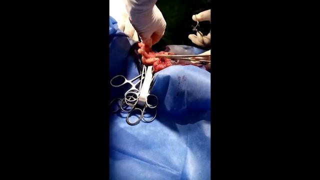 Caso quirúrgico: Laparotomia exploratoria, Corrección quirúrgica de hernia inguinal y OVH. смотреть онлайн