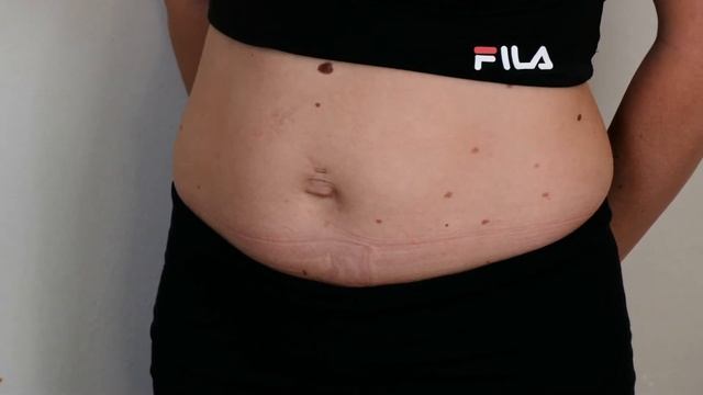Lipo Lax
