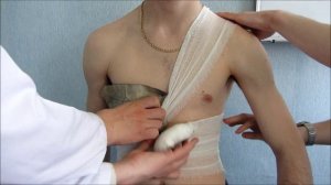 Окклюзионная повязка пневмоторакс