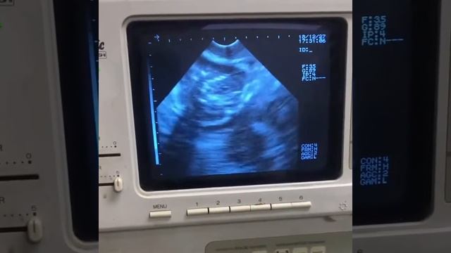 Ultra sound we’re bringing puppies home смотреть онлайн