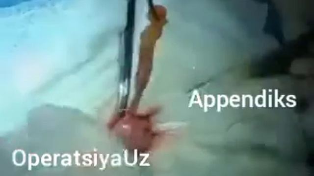 operatsiya смотреть онлайн