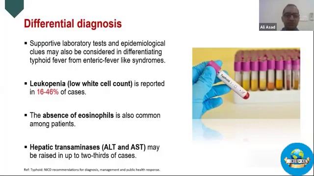 Typhoid Fever in the Pandemic Covid 19 смотреть онлайн