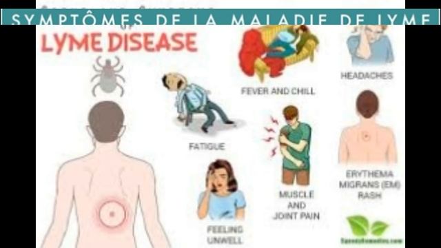 هل تعرف ان قرصة القراد يمكن ان تتسبب في مشكل صحي : مرض لايم !! Lyme disease смотреть онлайн